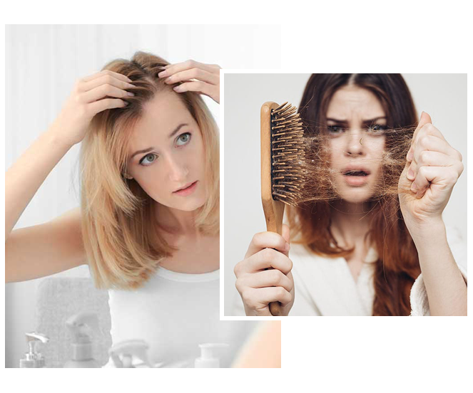 womens hair loss Toronto CA