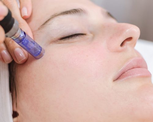 dermopen face treatment Hardware cosmetology, mesotherapy, treatment of cheek zone, face rejuvenation, close up